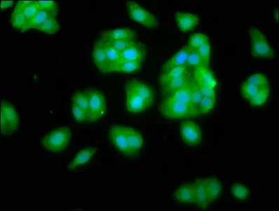 Immunocytochemistry/ Immunofluorescence - Anti-NANS antibody (AB236783)