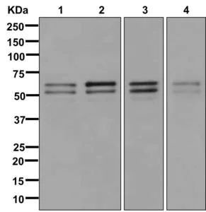 Western blot - Anti-NAP1L1 antibody [EPR11845] (AB178687)