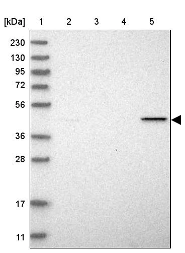 Western blot - Anti-NAPE-PLD antibody (AB246951)