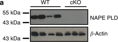 Western blot - Anti-NAPE-PLD antibody (AB95397)