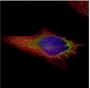 Immunocytochemistry/ Immunofluorescence - Anti-NAPRT1 antibody (AB127699), expandable thumbnail