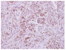 Immunohistochemistry (Formalin/PFA-fixed paraffin-embedded sections) - Anti-NAPRT1 antibody (AB127699), expandable thumbnail