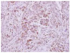 Immunohistochemistry (Formalin/PFA-fixed paraffin-embedded sections) - Anti-NAPRT1 antibody (AB127699)