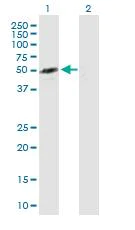 Western blot - Anti-NAPRT1 antibody (AB88562)