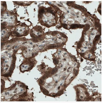Immunohistochemistry (Formalin/PFA-fixed paraffin-embedded sections) - Anti-NAPRT1 antibody [CL0366] (AB212028)