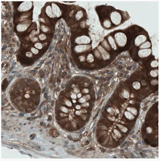 Immunohistochemistry (Formalin/PFA-fixed paraffin-embedded sections) - Anti-NAPRT1 antibody [CL0366] (AB212028)