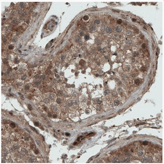 Immunohistochemistry (Formalin/PFA-fixed paraffin-embedded sections) - Anti-NAPRT1 antibody [CL0366] (AB212028)