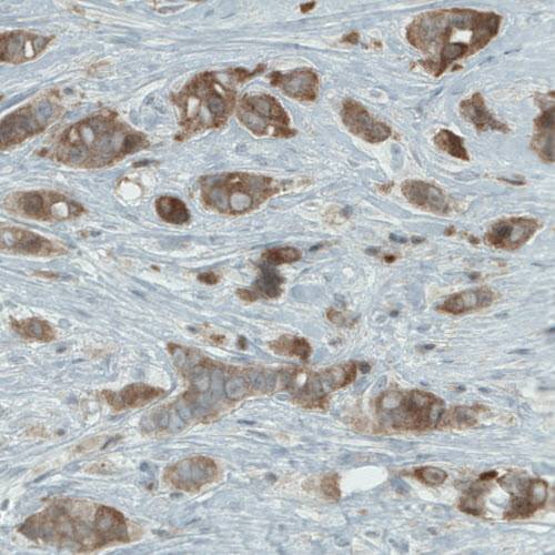 Immunohistochemistry (Formalin/PFA-fixed paraffin-embedded sections) - Anti-NAPRT1 antibody [CL0665] (AB211529), expandable thumbnail
