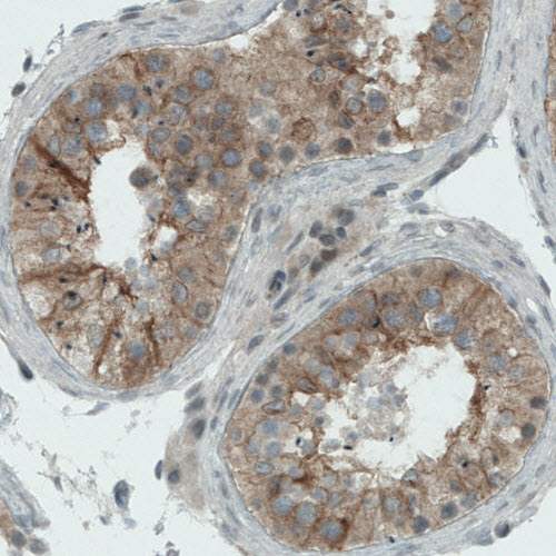 Immunohistochemistry (Formalin/PFA-fixed paraffin-embedded sections) - Anti-NAPRT1 antibody [CL0665] (AB211529), expandable thumbnail