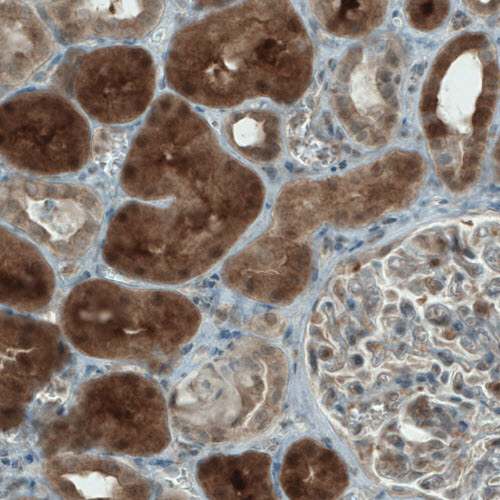 Immunohistochemistry (Formalin/PFA-fixed paraffin-embedded sections) - Anti-NAPRT1 antibody [CL0665] (ab211529), expandable thumbnail