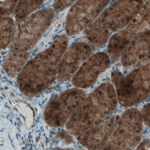 Immunohistochemistry (Formalin/PFA-fixed paraffin-embedded sections) - Anti-NAPRT1 antibody [CL0665] (AB211529), expandable thumbnail