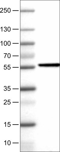 Western blot - Anti-NAPRT1 antibody [CL0665] (ab211529), expandable thumbnail