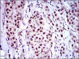 Immunohistochemistry (Formalin/PFA-fixed paraffin-embedded sections) - Anti-NAPSIN A antibody [10C4B8] (AB175426)
