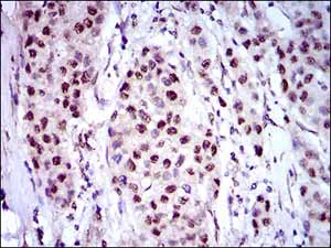 Immunohistochemistry (Formalin/PFA-fixed paraffin-embedded sections) - Anti-NAPSIN A antibody [10C4B8] (AB175426)