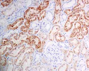 Immunohistochemistry (Formalin/PFA-fixed paraffin-embedded sections) - Anti-NAPSIN A antibody [EPR6252] (AB133249)