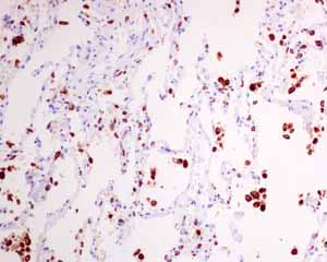 Immunohistochemistry (Formalin/PFA-fixed paraffin-embedded sections) - Anti-NAPSIN A antibody [EPR6252] (AB133249)