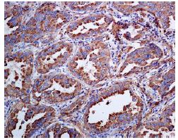 Immunohistochemistry (Formalin/PFA-fixed paraffin-embedded sections) - Anti-NAPSIN A antibody [EPR6252] (AB133249)