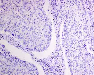 Immunohistochemistry (Formalin/PFA-fixed paraffin-embedded sections) - Anti-NAPSIN A antibody [EPR6252] - BSA and Azide free (AB248424)