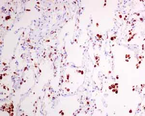 Immunohistochemistry (Formalin/PFA-fixed paraffin-embedded sections) - Anti-NAPSIN A antibody [EPR6252] - BSA and Azide free (AB248424)