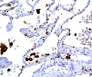Immunohistochemistry (Formalin/PFA-fixed paraffin-embedded sections) - Anti-NAPSIN A antibody [EPR6257] (AB129189)