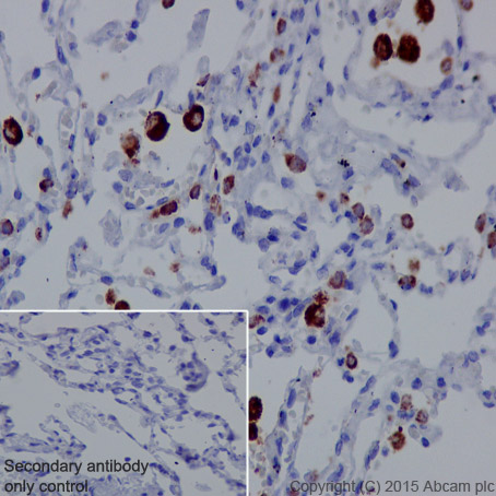 Immunohistochemistry (Formalin/PFA-fixed paraffin-embedded sections) - Anti-NAPSIN A antibody [EPR6257] - BSA and Azide free (AB248340), expandable thumbnail