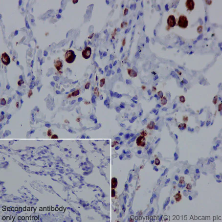 Immunohistochemistry (Formalin/PFA-fixed paraffin-embedded sections) - Anti-NAPSIN A antibody [EPR6257] - BSA and Azide free (AB248340)