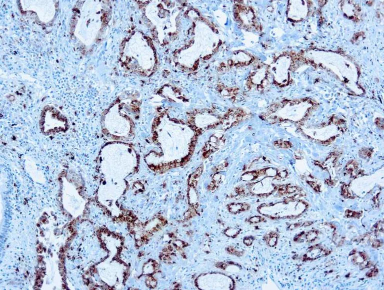 Immunohistochemistry (Formalin/PFA-fixed paraffin-embedded sections) - Anti-NAPSIN A antibody [KCG1.1] (AB73021)