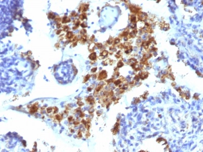 Immunohistochemistry (Formalin/PFA-fixed paraffin-embedded sections) - Anti-NAPSIN A antibody [NAPSA/1238] (AB234002)