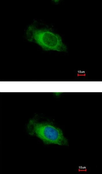 Immunocytochemistry/ Immunofluorescence - Anti-Nardilysin antibody (AB154237)