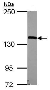 Western blot - Anti-Nardilysin antibody (AB154237)