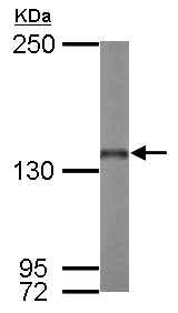 Western blot - Anti-Nardilysin antibody (AB154237)
