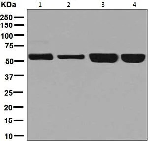 Western blot - Anti-NARS antibody [EPR8221] - BSA and Azide free (AB248320)