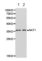 Western blot - Anti-NAT1 antibody (AB175088)