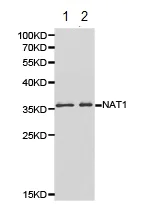 Western blot - Anti-NAT1 antibody (AB175088)