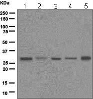 Western blot - Anti-NAT1 antibody [EPR3221(2)] (AB109114), expandable thumbnail