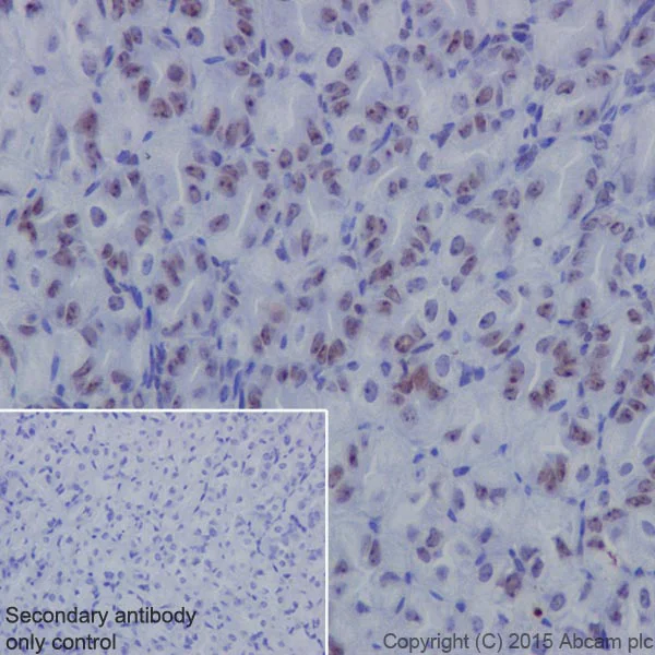 Immunohistochemistry (Formalin/PFA-fixed paraffin-embedded sections) - Anti-NAT10 antibody [EPR18663] (AB194297)