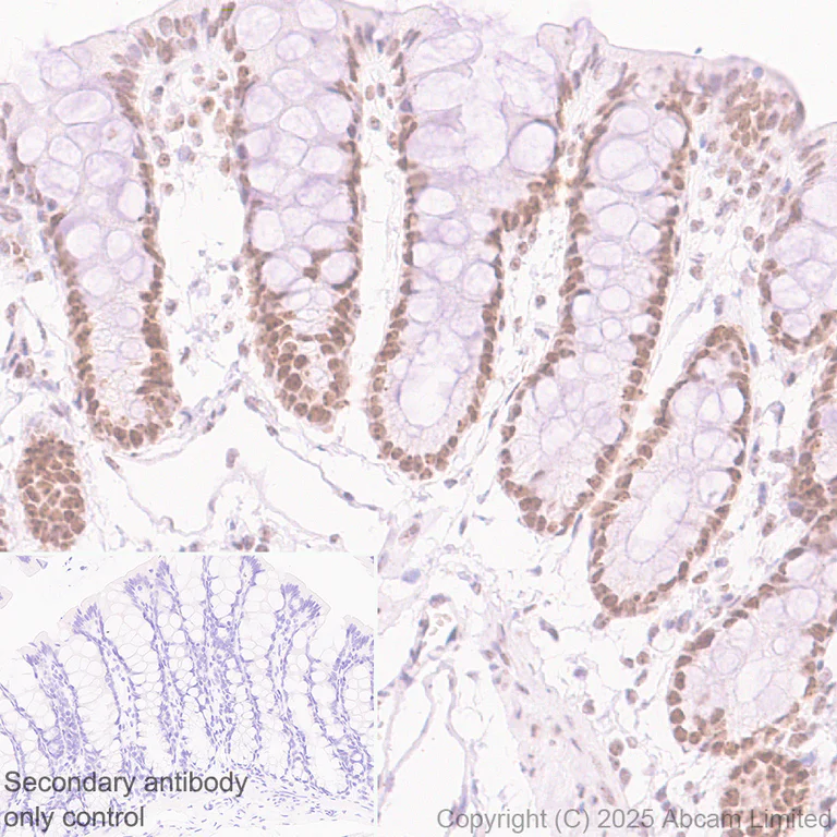 Immunohistochemistry (Formalin/PFA-fixed paraffin-embedded sections) - Anti-NAT10 antibody [EPR18663] (AB194297)