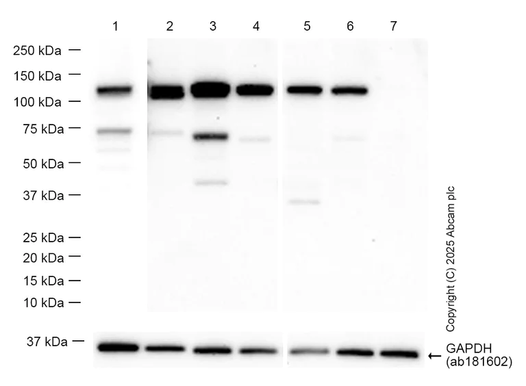 Western blot - Anti-NAT10 antibody [EPR18663] (AB194297)