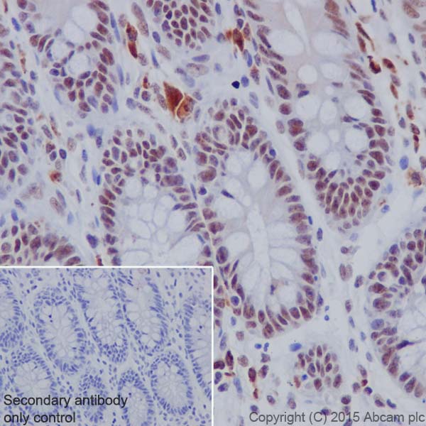 Immunohistochemistry (Formalin/PFA-fixed paraffin-embedded sections) - Anti-NAT10 antibody [EPR18663] - BSA and Azide free (ab251186), expandable thumbnail