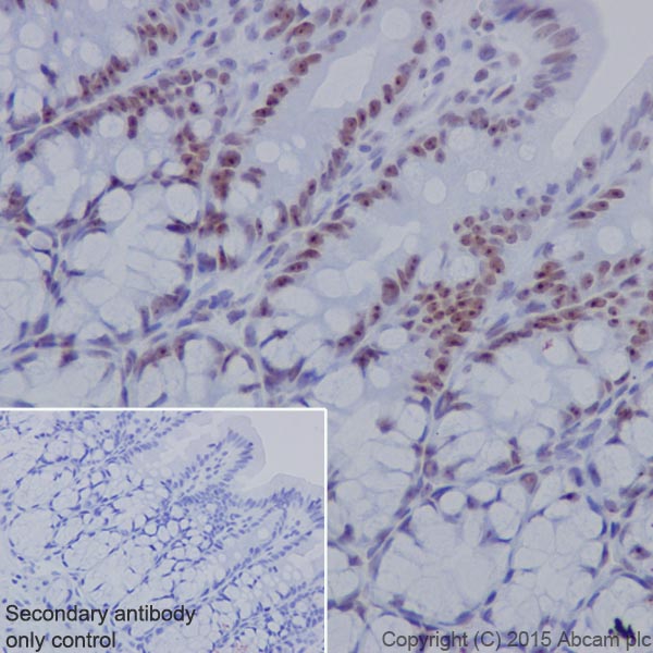 Immunohistochemistry (Formalin/PFA-fixed paraffin-embedded sections) - Anti-NAT10 antibody [EPR18663] - BSA and Azide free (AB251186), expandable thumbnail