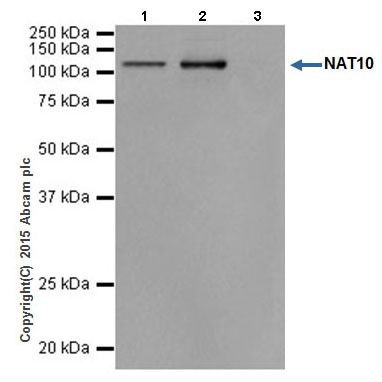 Immunoprecipitation - Anti-NAT10 antibody [EPR18663] - BSA and Azide free (AB251186), expandable thumbnail