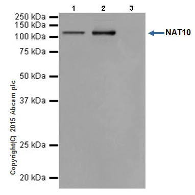 Immunoprecipitation - Anti-NAT10 antibody [EPR18663] - BSA and Azide free (AB251186)