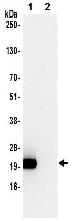 Immunoprecipitation - Anti-NAT13 antibody (AB241487)