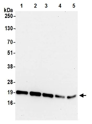 Western blot - Anti-NAT13 antibody (AB241487)