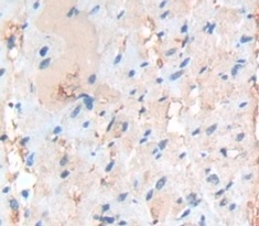 Immunohistochemistry (Formalin/PFA-fixed paraffin-embedded sections) - Anti-NAT2/AT-2 antibody (AB232822), expandable thumbnail