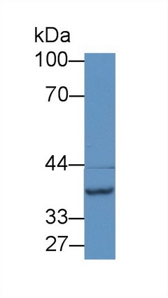 Western blot - Anti-NAT2/AT-2 antibody (AB232822), expandable thumbnail