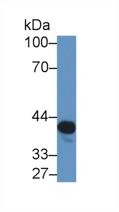 Western blot - Anti-NAT2/AT-2 antibody (AB232822), expandable thumbnail