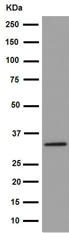 Western blot - Anti-NAT2/AT-2 antibody [EPR15856] - BSA and Azide free (AB251180)