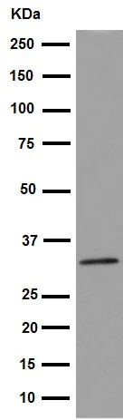 Western blot - Anti-NAT2/AT-2 antibody [EPR15856] - BSA and Azide free (AB251180)