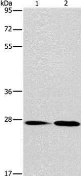 Western blot - Anti-NAT8 antibody (AB197793)